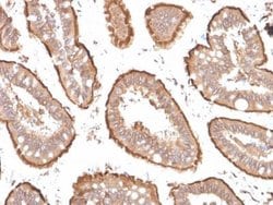 Villin 1 Mouse anti-Human, Clone: VIL1/1314 + VIL1/2376, Novus Biologicals